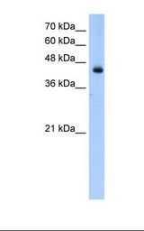 Transfected 293T cell lysate. Antibody concentration: 0.25 ug/ml. Gel concentration: 12%.