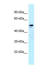 ARFGAP3 antibody LS-C145995 Western blot of Fetal Lung lysate. Antibody concentration 1 ug/ml.