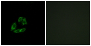Immunofluorescence of A549 cells, using ARFIP1 Antibody. The picture on the right is treated with the synthesized peptide.