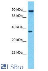 ARFIP1 antibody Western Blot of MDA-MB-435s. Antibody dilution: 1 ug/ml.