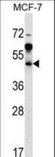 ARFIP1 Antibody western blot of MCF-7 cell line lysates (35 ug/lane). The ARFIP1 antibody detected the ARFIP1 protein (arrow).