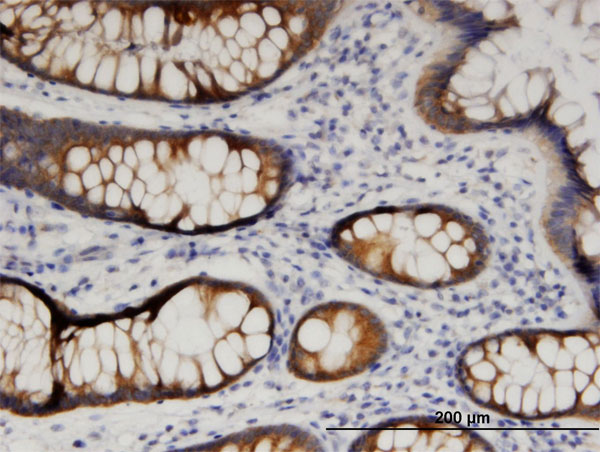 Immunoperoxidase of monoclonal antibody to ARFIP1 on formalin-fixed paraffin-embedded human colon. [antibody concentration 3 ug/ml]