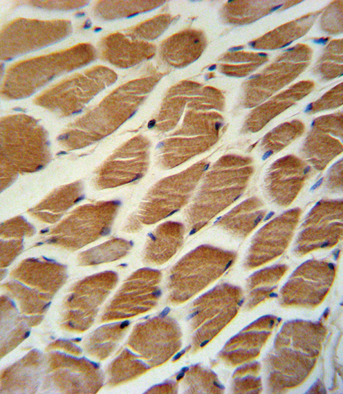 ACADL Antibody immunohistochemistry of formalin-fixed and paraffin-embedded human skeletal muscle followed by peroxidase-conjugated secondary antibody and DAB staining.