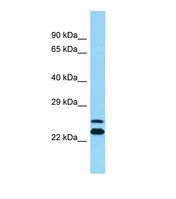 Western blot of Human THP-1. ARFIP2 antibody dilution 1.0 ug/ml.
