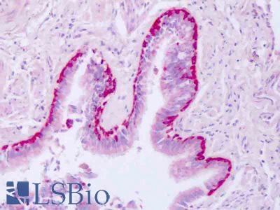 Anti-ARFL3 / ARL3 antibody IHC of human lung. Immunohistochemistry of formalin-fixed, paraffin-embedded tissue after heat-induced antigen retrieval. Antibody LS-B8497 dilution 5-7.5 ug/ml.