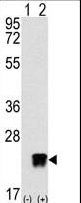 Western blot of ARL3 (arrow) using rabbit polyclonal ARL3 Antibody. 293 cell lysates (2 ug/lane) either nontransfected (Lane 1) or transiently transfected with the ARL3 gene (Lane 2) (Origene Technologies).