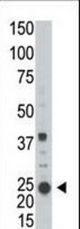 Western blot of anti-ARL3 in A2058 cell line lysate (35 ug/lane). ARL3 (arrow) was detected using the purified antibody.