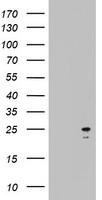 HEK293T cells were transfected with the pCMV6-ENTRY control (Left lane) or pCMV6-ENTRY ARL3 (Right lane) cDNA for 48 hrs and lysed. Equivalent amounts of cell lysates (5 ug per lane) were separated by SDS-PAGE and immunoblotted with anti-ARL3.