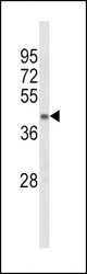 Western blot of ACADL Antibody in mouse kidney tissue lysates (35 ug/lane). ACADL (arrow) was detected using the purified antibody.