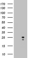 HEK293T cells were transfected with the pCMV6-ENTRY control (Left lane) or pCMV6-ENTRY ARL3 (Right lane) cDNA for 48 hrs and lysed. Equivalent amounts of cell lysates (5 ug per lane) were separated by SDS-PAGE and immunoblotted with anti-ARL3.