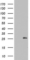 HEK293T cells were transfected with the pCMV6-ENTRY control (Left lane) or pCMV6-ENTRY ARL3 (Right lane) cDNA for 48 hrs and lysed. Equivalent amounts of cell lysates (5 ug per lane) were separated by SDS-PAGE and immunoblotted with anti-ARL3.