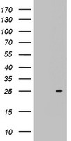 HEK293T cells were transfected with the pCMV6-ENTRY control (Left lane) or pCMV6-ENTRY ARL3 (Right lane) cDNA for 48 hrs and lysed. Equivalent amounts of cell lysates (5 ug per lane) were separated by SDS-PAGE and immunoblotted with anti-ARL3.
