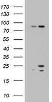 HEK293T cells were transfected with the pCMV6-ENTRY control (Left lane) or pCMV6-ENTRY ARL3 (Right lane) cDNA for 48 hrs and lysed. Equivalent amounts of cell lysates (5 ug per lane) were separated by SDS-PAGE and immunoblotted with anti-ARL3.