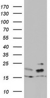 HEK293T cells were transfected with the pCMV6-ENTRY control (Left lane) or pCMV6-ENTRY ARL3 (Right lane) cDNA for 48 hrs and lysed. Equivalent amounts of cell lysates (5 ug per lane) were separated by SDS-PAGE and immunoblotted with anti-ARL3.