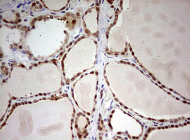 IHC of paraffin-embedded Human thyroid tissue using anti-ARL3 mouse monoclonal antibody. (Heat-induced epitope retrieval by 10mM citric buffer, pH6.0, 120°C for 3min).