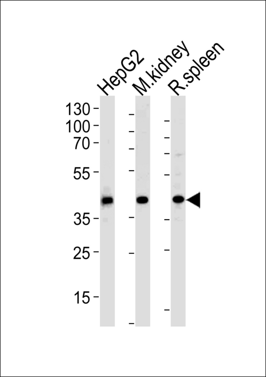 Western blot of lysates from HepG2 cell line and mouse kidney, rat spleen tissue lysates(from left to right), using ACADL Antibody. Antibody was diluted at 1:1000 at each lane. A goat anti-rabbit IgG H&L (HRP) at 1:5000 dilution was used as the secondary antibody. Lysates at 35ug per lane.