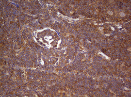 IHC of paraffin-embedded Human lymphoma tissue using anti-ARL3 mouse monoclonal antibody. (Heat-induced epitope retrieval by 10mM citric buffer, pH6.0, 120°C for 3min).