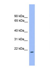 ARL3 antibody LS-C135578 Western blot of MCF7 Cell lysate. Antibody concentration 1 ug/ml.