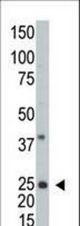 Western blot of anti-hARL3 -M1 antibody in A2058 cell line lysate (35 ug/lane). hARL3 -M1(arrow) was detected using the purified antibody.
