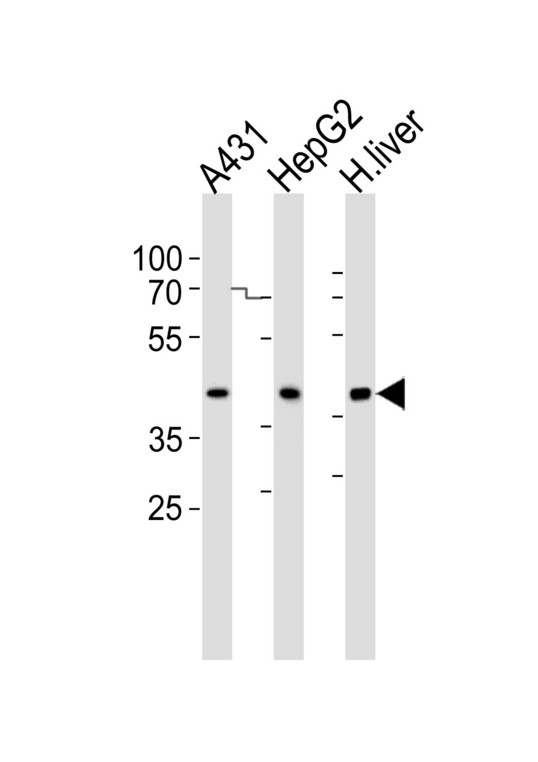 Western blot of lysates from A431, HepG2 cell line and human liver tissue lysate (from left to right) with ACADSB Antibody. Antibody was diluted at 1:1000 at each lane. A goat anti-rabbit IgG H&L (HRP) at 1:5000 dilution was used as the secondary antibody. Lysates at 35 ug per lane.