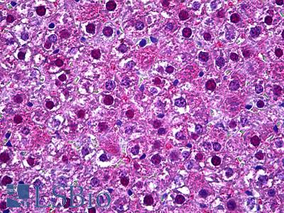 Anti-ARG1 antibody IHC of human liver. Immunohistochemistry of formalin-fixed, paraffin-embedded tissue after heat-induced antigen retrieval. Antibody LS-B5756 concentration 3.75 ug/ml.