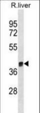 Rat Arg1 Antibody western blot of rat liver tissue lysates (35 ug/lane). The Rat Arg1 antibody detected the Rat Arg1 protein (arrow).