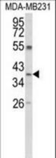 Western blot of ARG1 Antibody in MDA-MB231 cell line lysates (35 ug/lane). ARG1 (arrow) was detected using the purified antibody.