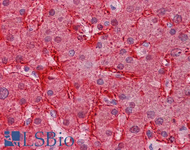 Anti-ARG1 antibody IHC of human liver. Immunohistochemistry of formalin-fixed, paraffin-embedded tissue after heat-induced antigen retrieval. Antibody LS-B6245 concentration 3.75 ug/ml.
