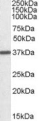 ARG1 antibody (0.01 ug/ml) staining of Human Liver lysate (35 ug protein/ml in RIPA buffer). Primary incubation was 1 hour. Detected by chemiluminescence.