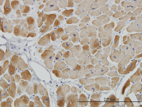 Immunoperoxidase of monoclonal antibody to ACADVL on formalin-fixed paraffin-embedded human heart. [antibody concentration 3 ug/ml]