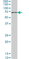 ACADVL monoclonal antibody (M01), clone 5D3 Western blot of ACADVL expression in HeLa NE.