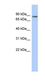 TMTC1 antibody LS-C111226 Western blot of Fetal Spleen lysate.