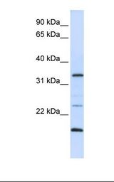 293T cell lysate. Antibody concentration: 1.0 ug/ml. Gel concentration: 12%.