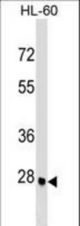 ARGFX Antibody western blot of HL-60 cell line lysates (35 ug/lane). The ARGFX antibody detected the ARGFX protein (arrow).