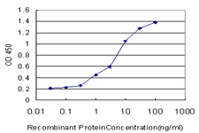Detection limit for recombinant GST tagged ACADVL is approximately 0.03 ng/ml as a capture antibody.