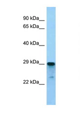 ARGLU1 antibody LS-C146362 Western blot of Mouse Spleen lysate. Antibody concentration 1 ug/ml.