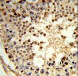 Formalin-fixed and paraffin-embedded human testis tissue reacted with ARGLU1 Antibody , which was peroxidase-conjugated to the secondary antibody, followed by DAB staining. This data demonstrates the use of this antibody for immunohistochemistry; clinical relevance has not been evaluated.