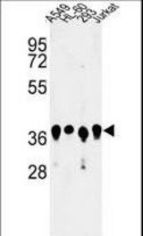 Western blot of ARGLU1 Antibody in A549, HL-60, 293, Jurkat cell line lysates (35 ug/lane). ARGLU1 (arrow) was detected using the purified antibody.