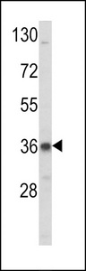 Western blot of LDLRAP1 Antibody in K562 cell line lysates (35 ug/lane). LDLRAP1 (arrow) was detected using the purified antibody.