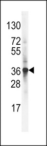 Western blot of LDLRAP1 Antibody in NCI-H460 cell line lysates (35 ug/lane). LDLRAP1 (arrow) was detected using the purified antibody.