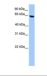 HepG2 cell lysate. Antibody concentration: 1.17 ug/ml. Gel concentration: 12%.