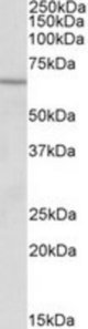 ACADVL antibody (2 ug/ml) staining of Human Heart lysate (35 ug protein/ml in RIPA buffer). Primary incubation was 1 hour. Detected by chemiluminescence.