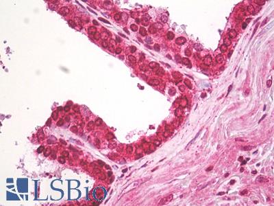 Human Prostate: Formalin-Fixed, Paraffin-Embedded (FFPE)