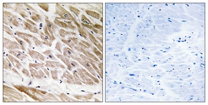 IHC of paraffin-embedded human heart tissue, using RHG1 Antibody. The sample on the right was incubated with synthetic peptide.