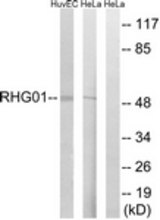 Western blot of extracts from HeLa/HUVEC cells, using RHG1 Antibody. The lane on the right was incubated with synthetic peptide.