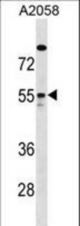 ARHGAP1 Antibody western blot of A2058 cell line lysates (35 ug/lane). The ARHGAP1 antibody detected the ARHGAP1 protein (arrow).