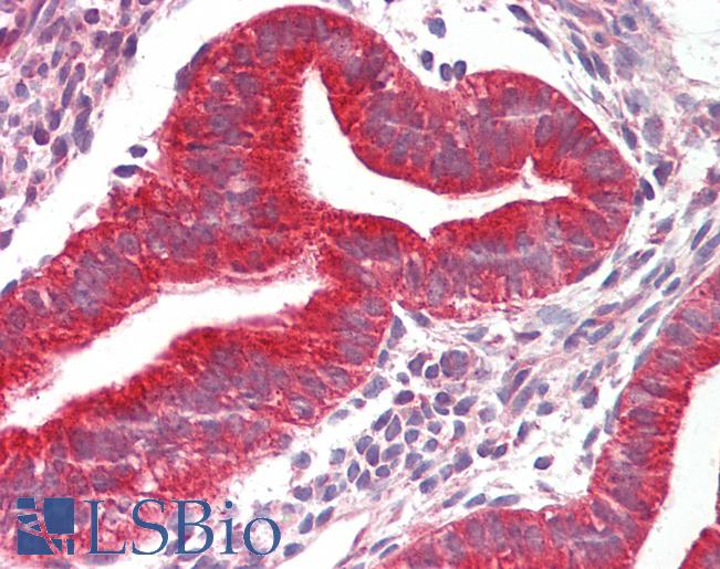 Human Uterus: Formalin-Fixed, Paraffin-Embedded (FFPE)