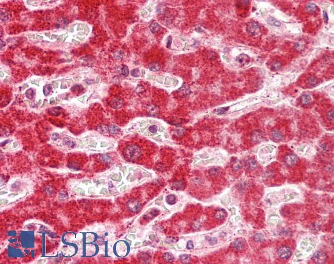 Human Liver: Formalin-Fixed, Paraffin-Embedded (FFPE)