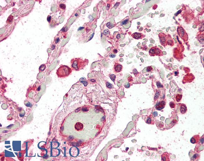 Anti-ACAP2 / CENTB2 antibody IHC of human lung. Immunohistochemistry of formalin-fixed, paraffin-embedded tissue after heat-induced antigen retrieval. Antibody LS-B2282 concentration 5 ug/ml.
