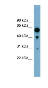 ARHGAP15 antibody LS-C112011 Western blot of 293T cell lysate.